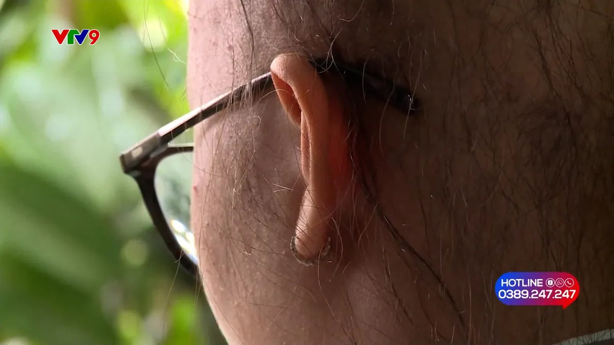 Alo V9 (30/01/2026): Hàng loạt người đổ nợ khi sử dụng dịch vụ mọc lại tóc