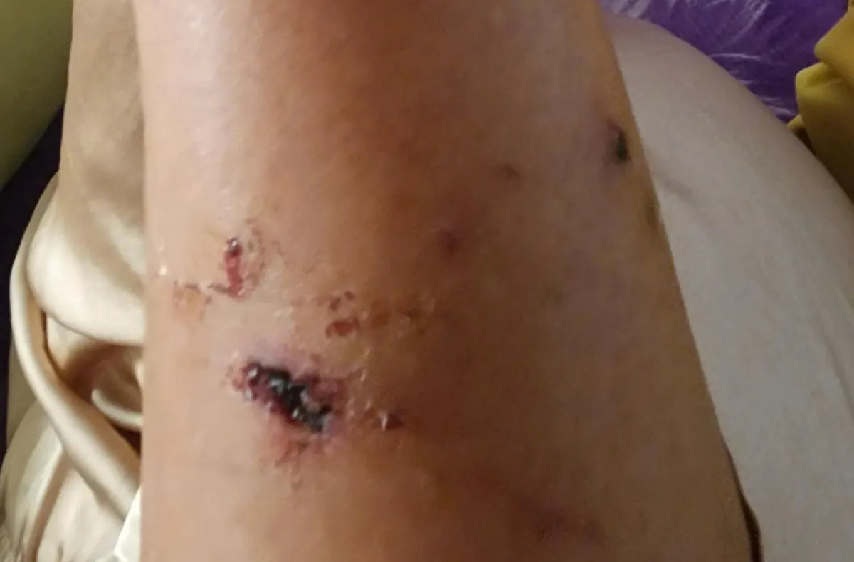 TP Hồ Ch&iacute; Minh: Khỉ rượt đuổi, tấn c&ocirc;ng người đi bộ tr&ecirc;n N&uacute;i Lớn Vũng T&agrave;u  - Ảnh 2.