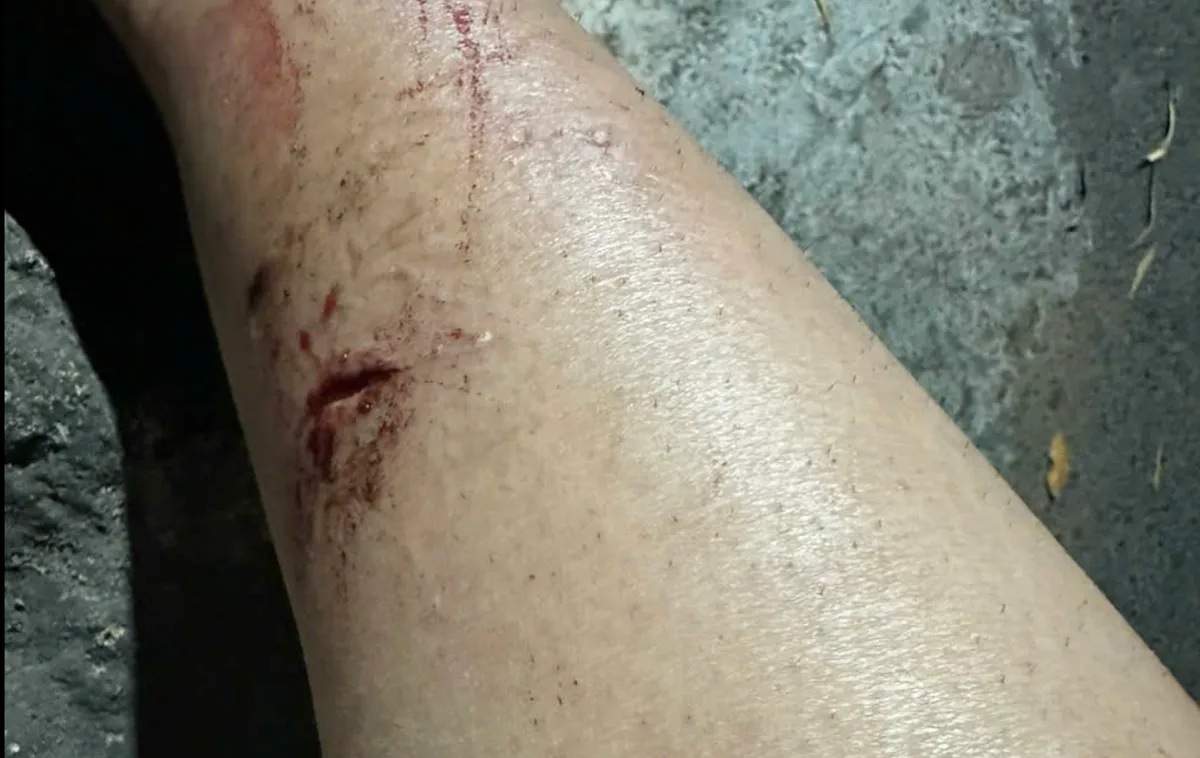 TP Hồ Ch&iacute; Minh: Th&ecirc;m nhiều nạn nh&acirc;n bị khỉ tấn c&ocirc;ng tr&ecirc;n N&uacute;i Lớn Vũng T&agrave;u  - Ảnh 2.