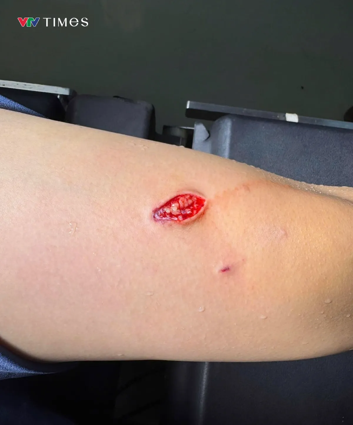 TP Hồ Ch&iacute; Minh: Th&ecirc;m nhiều nạn nh&acirc;n bị khỉ tấn c&ocirc;ng tr&ecirc;n N&uacute;i Lớn Vũng T&agrave;u  - Ảnh 1.