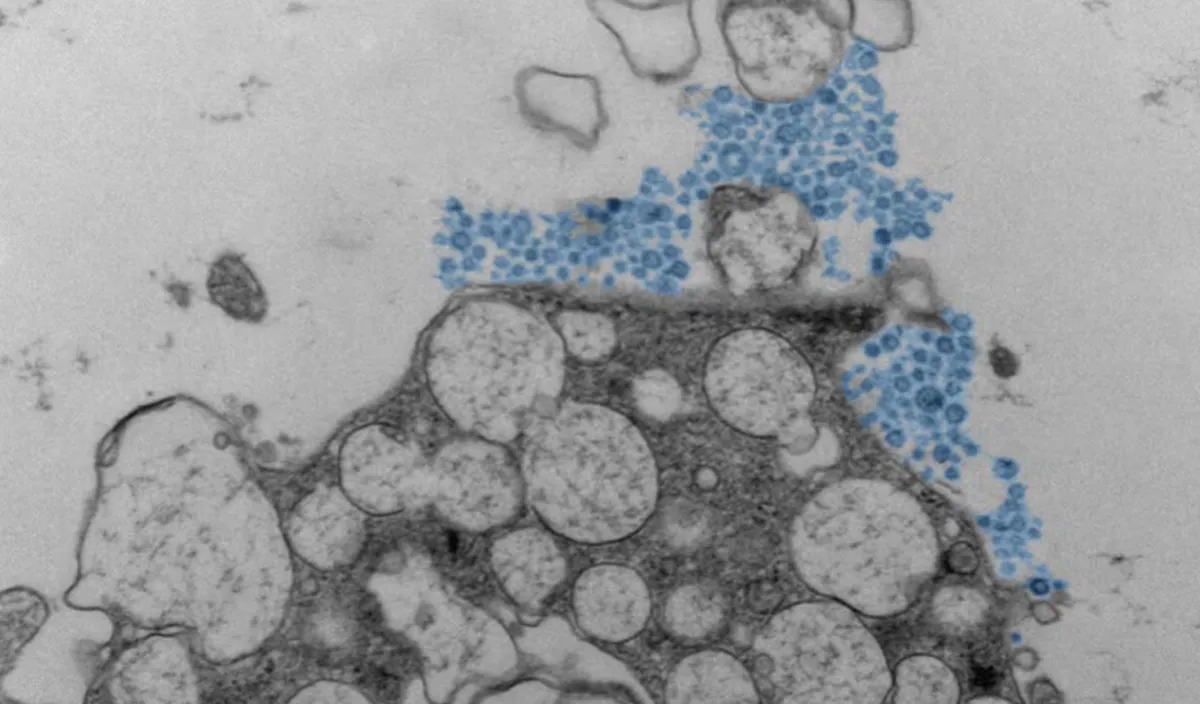 L&yacute; do virus cảm lạnh ảnh hưởng mỗi người theo c&aacute;ch kh&aacute;c nhau- Ảnh 1.