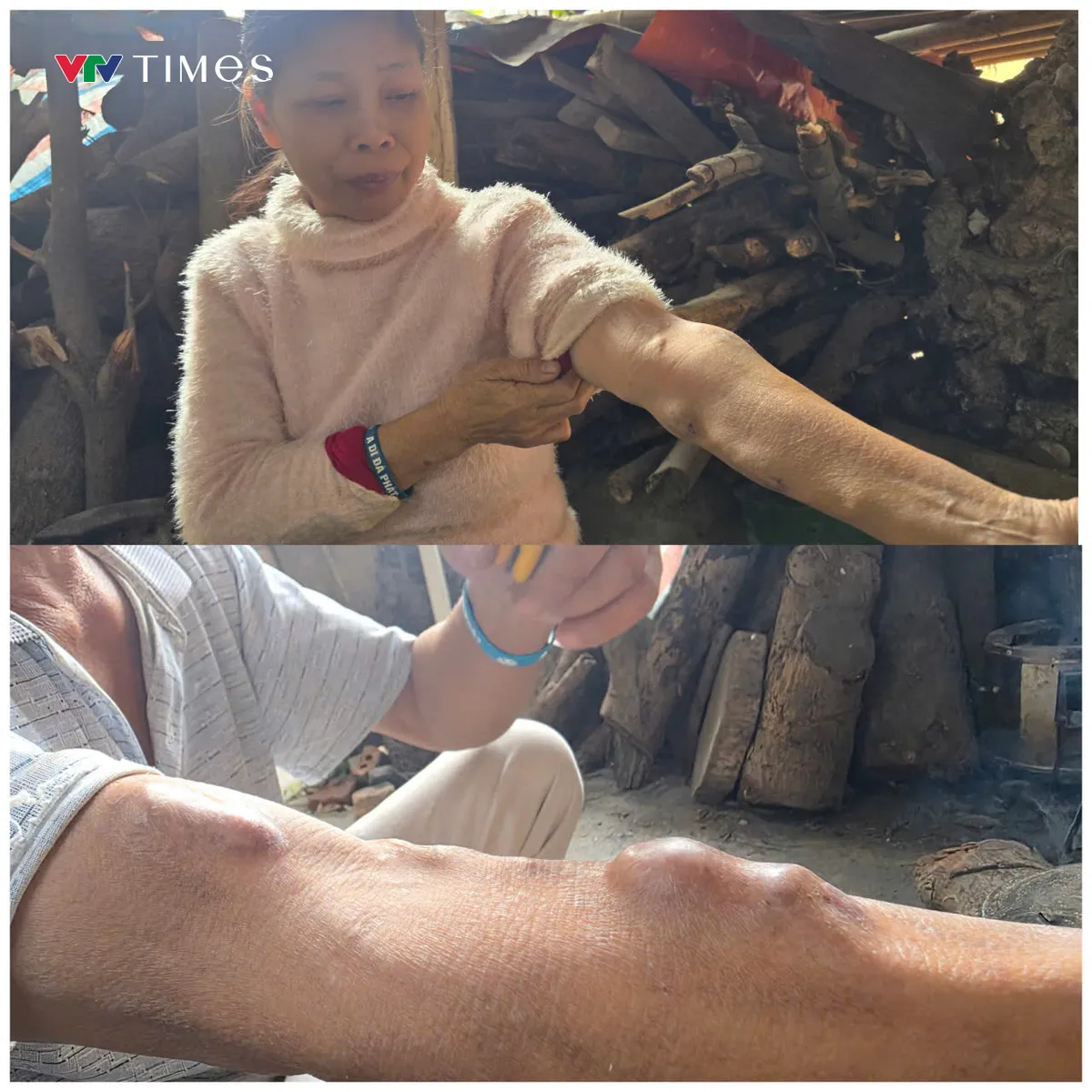 Ph&uacute; Thọ: &ldquo;X&oacute;m chạy thận&rdquo; &ndash; Nơi nghị lực được thắp l&ecirc;n từ những sẻ chia giản dị - Ảnh 2.