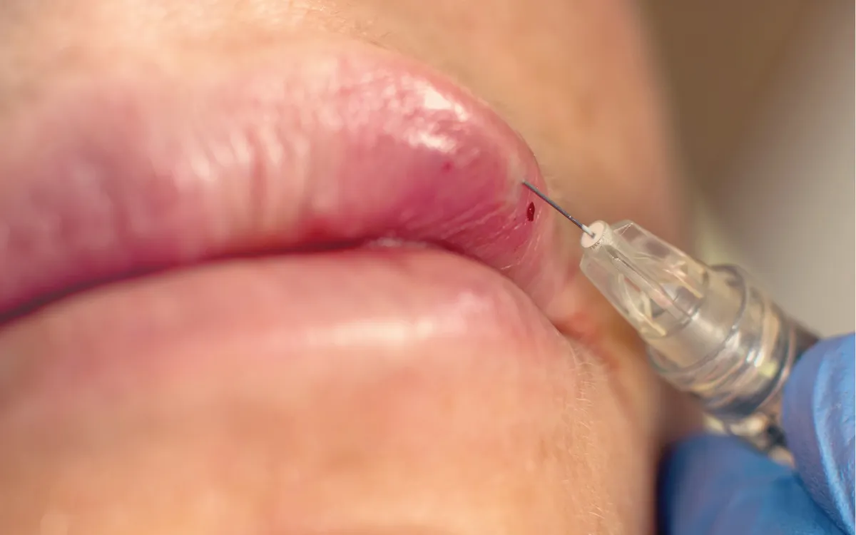 Ảnh minh họa: Getty Images