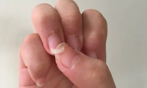 Những dấu hiệu cơ thể cảnh báo thiếu khoáng chất- Ảnh 1. Những dấu hiệu cơ thể cảnh báo thiếu khoáng chất- Ảnh 1.