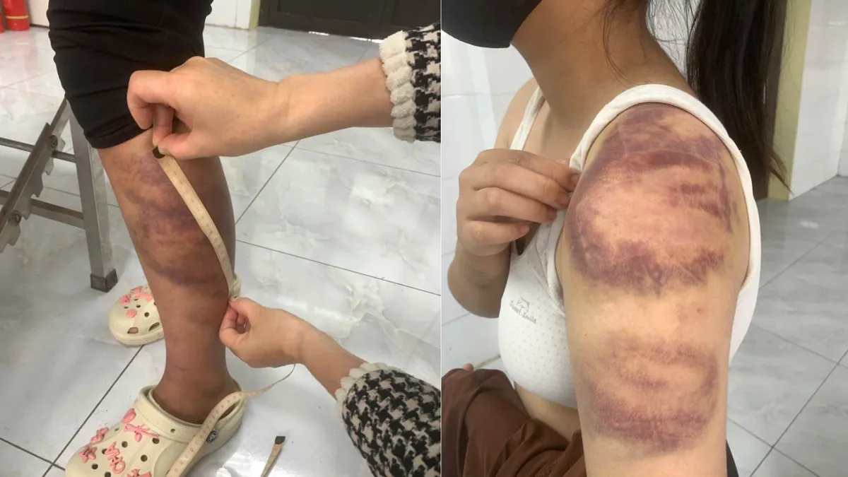 Tạm giữ người đàn ông trói, đánh con ruột, hành hạ vợ mang thai ở Bắc Ninh- Ảnh 1. Tạm giữ người đàn ông trói, đánh con ruột, hành hạ vợ mang thai ở Bắc Ninh- Ảnh 1.