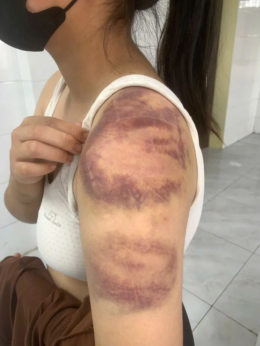 Khởi tố kẻ nhiều lần đ&aacute;nh đập vợ đang mang thai v&agrave; con g&aacute;i - Ảnh 1.