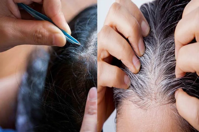 Nhổ một sợi t&oacute;c c&oacute; khiến nhiều sợi kh&aacute;c mọc l&ecirc;n?- Ảnh 1.