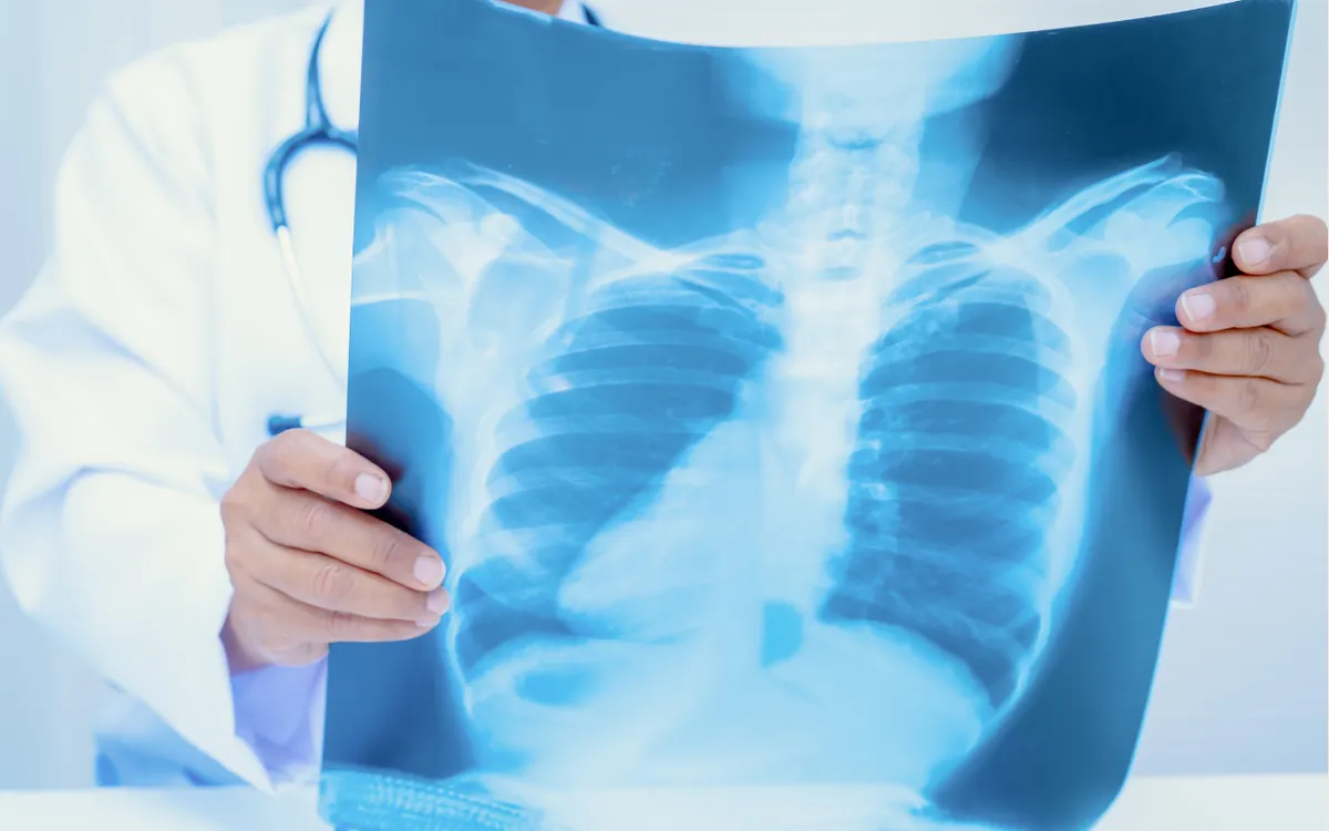 Ảnh minh họa: Sasirin Pamai's Images