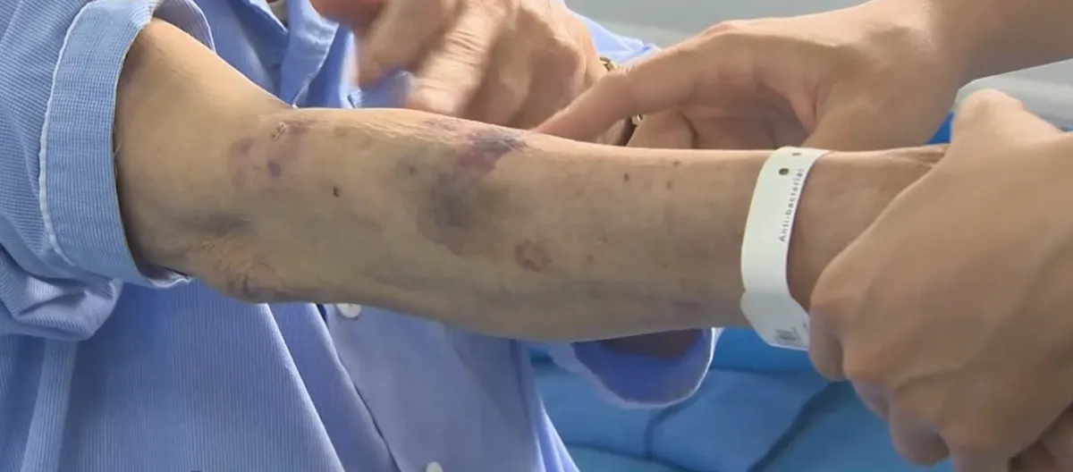 Gia tăng biến chứng nặng do sử dụng thuốc Nam kh&ocirc;ng r&otilde; nguồn gốc- Ảnh 1.