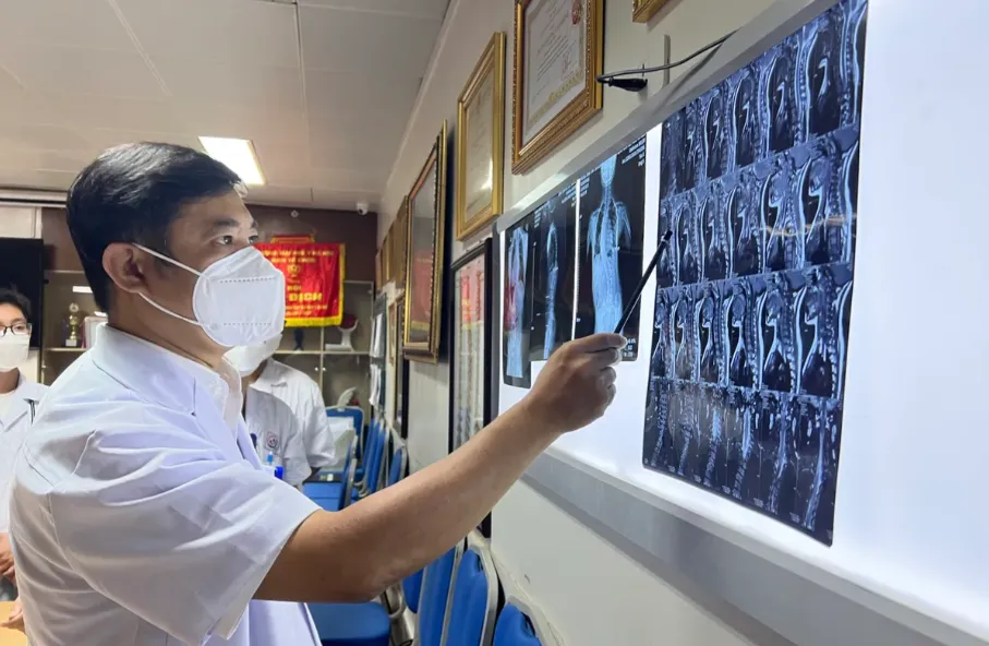 Kh&aacute;m, tư vấn miễn ph&iacute; g&ugrave; vẹo cột sống cho trẻ em- Ảnh 1.