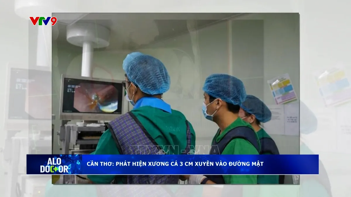 Alo Doctor (27/3/2026): Cần Thơ: Phát hiện xương cá 3cm xuyên vào đường mật