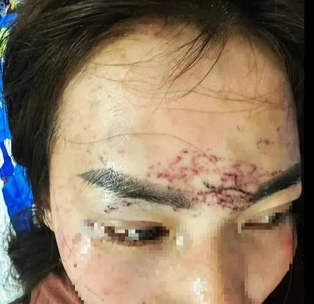 Hai phụ nữ ở C&agrave; Mau lĩnh &aacute;n t&ugrave; trong vụ bắt giữ, g&acirc;y thương t&iacute;ch do ghen tu&ocirc;ng- Ảnh 1.