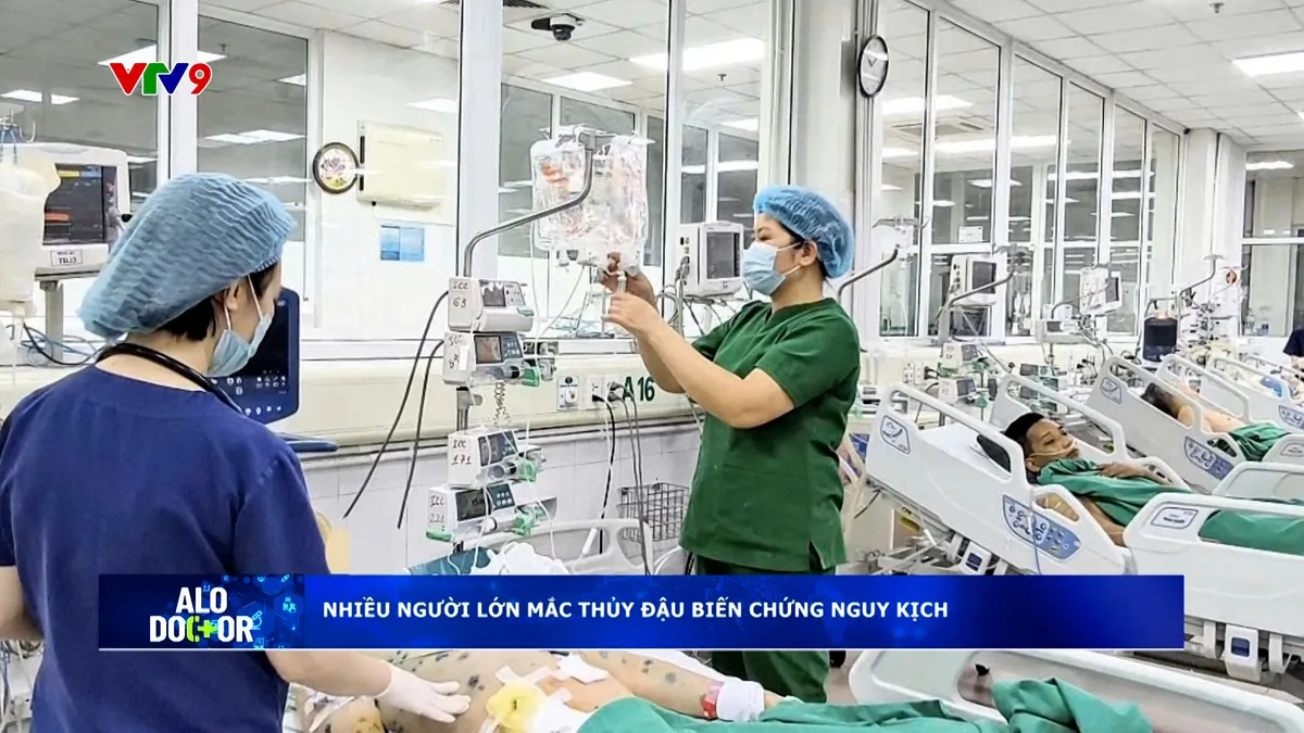 Alo Doctor (28/3/2026): Nhiều người lớn mắc thủy đậu biến chứng nguy kịch