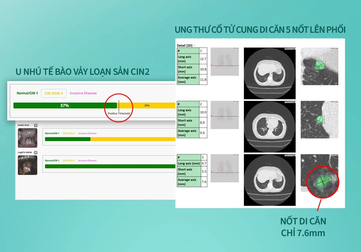 10 năm cuối đời sống chung bệnh tật: Người Việt đang thiếu điều g&igrave;?- Ảnh 3.