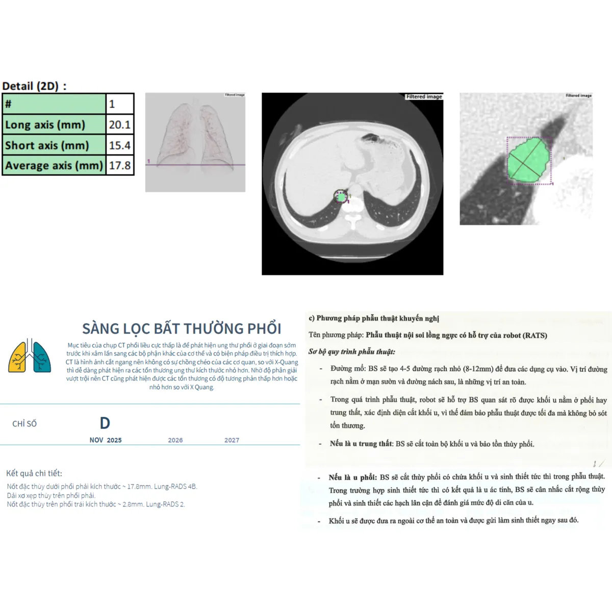 10 năm cuối đời sống chung bệnh tật: Người Việt đang thiếu điều g&igrave;?- Ảnh 6.