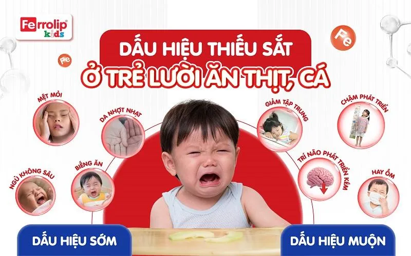 Cứ 3 trẻ c&oacute; 1 trẻ thiếu sắt: Nhận diện 4 nh&oacute;m nguy cơ cao để can thiệp sớm- Ảnh 1.