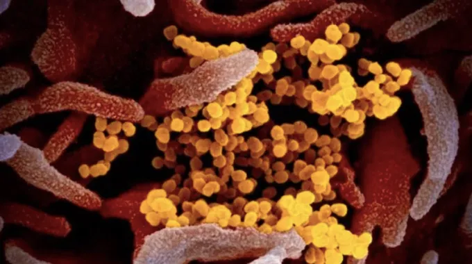 Bộ Y tế cảnh b&aacute;o biến thể Covid &ldquo;ve sầu&rdquo;: Kh&ocirc;ng hoang mang nhưng cũng kh&ocirc;ng chủ quan- Ảnh 1.