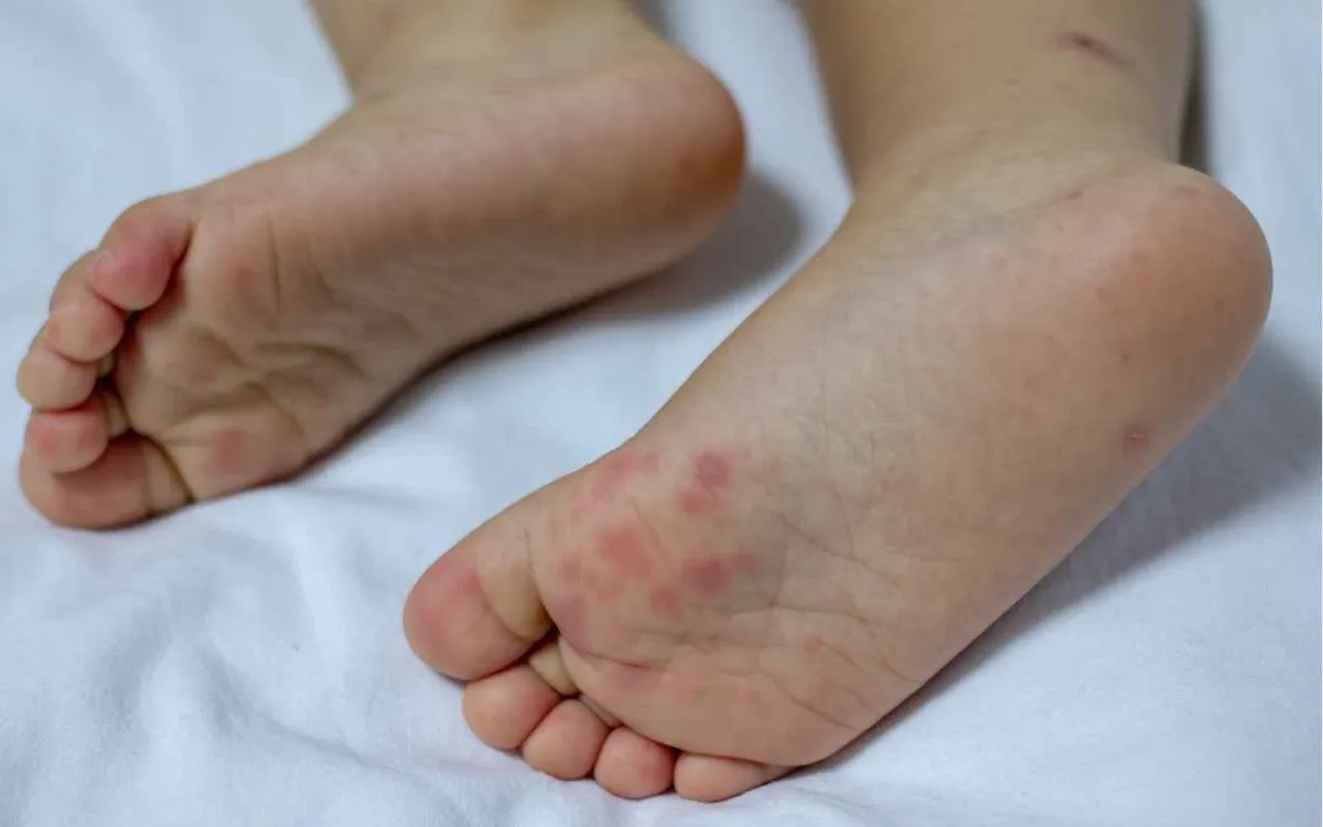 Ảnh minh họa: Getty Images