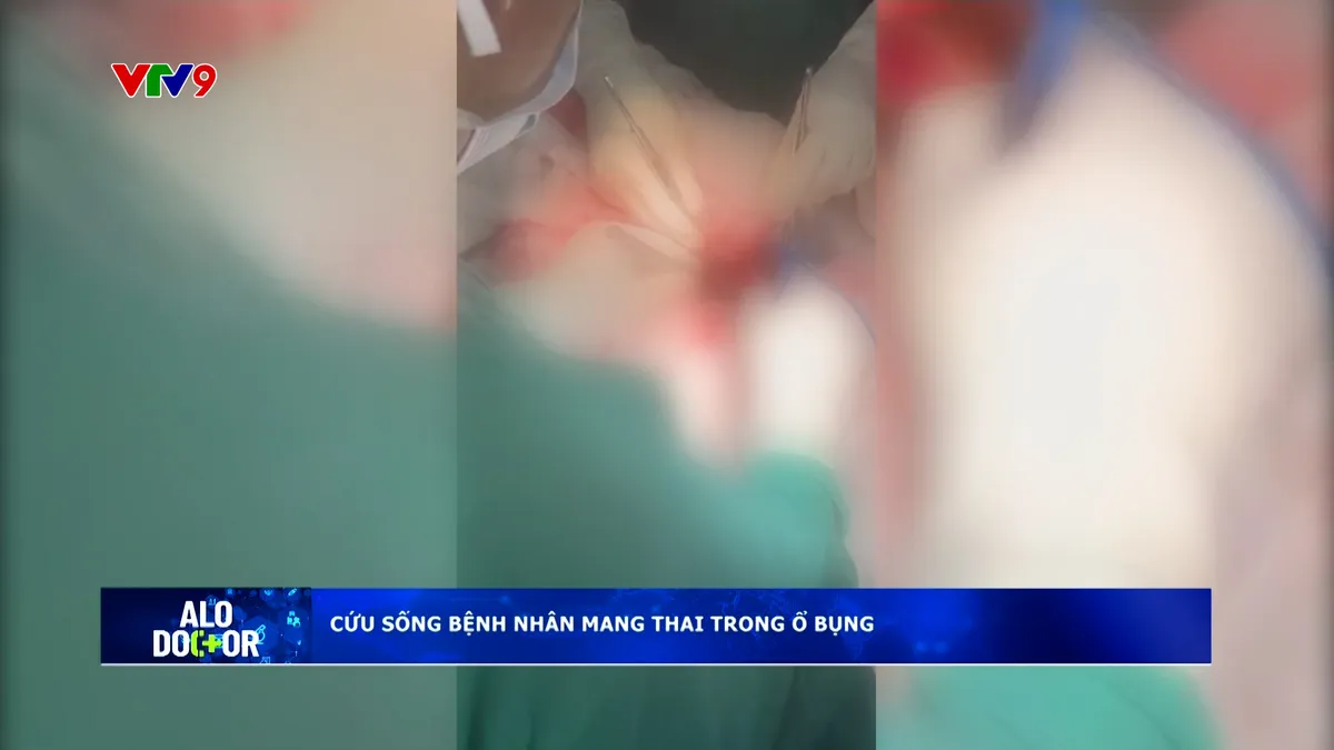 Alo Doctor (01/4/2026): Cứu sống bệnh nhân mang thai trong ổ bụng