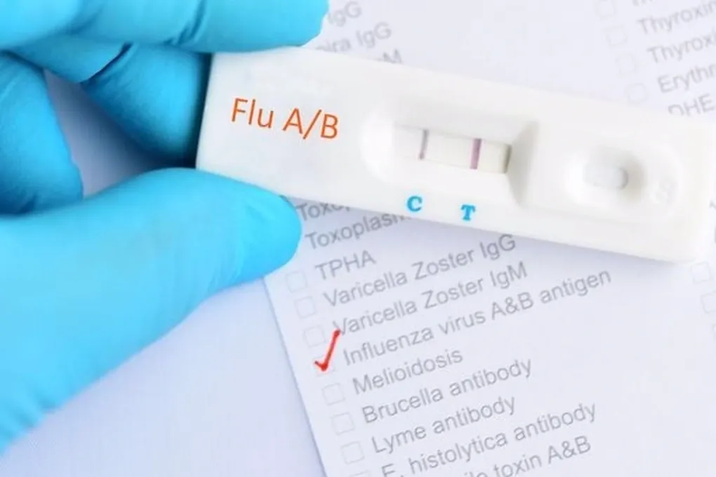 C&uacute;m m&ugrave;a tưởng nhẹ nhưng c&oacute; thể g&acirc;y biến chứng nặng- Ảnh 1.