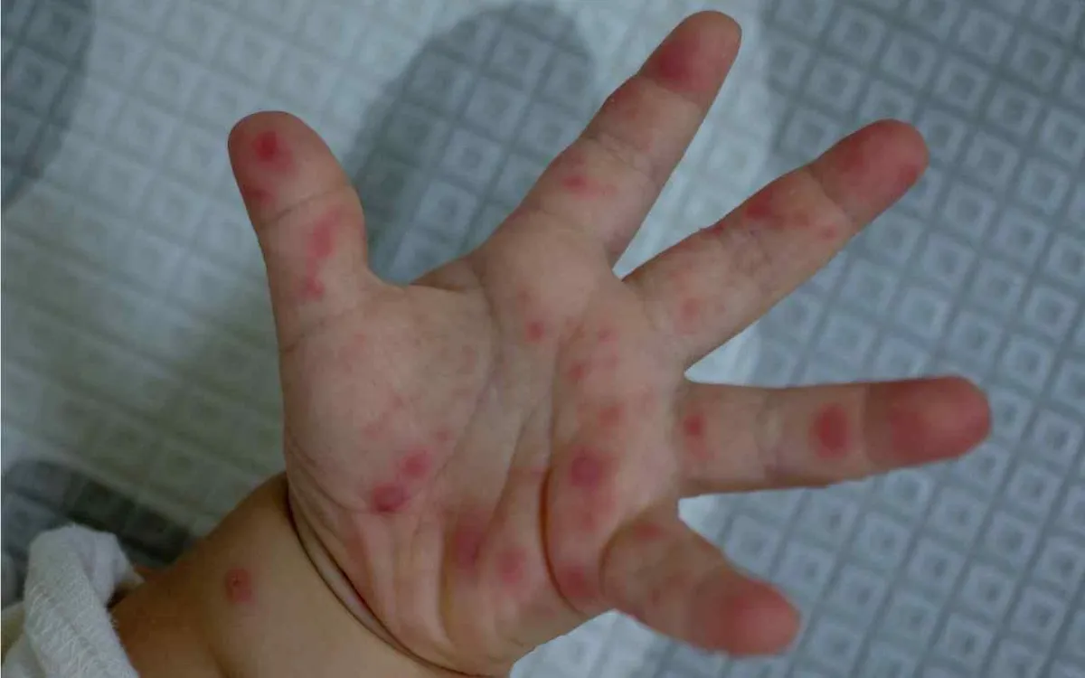 Ảnh minh họa: Getty Images