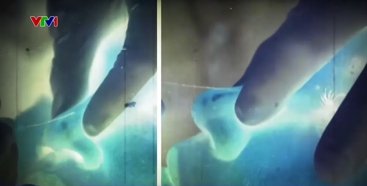 Cảnh b&aacute;o biến chứng thẩm mỹ khi l&agrave;m đẹp tại cơ sở kh&ocirc;ng đảm bảo an to&agrave;n  - Ảnh 1.