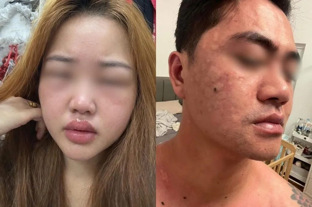 Bánh trứng kiến “gây sốt” dịp Thanh Minh: Cảnh báo nguy cơ dị ứng khi thử lần đầu- Ảnh 1. Bánh trứng kiến “gây sốt” dịp Thanh Minh: Cảnh báo nguy cơ dị ứng khi thử lần đầu- Ảnh 1.