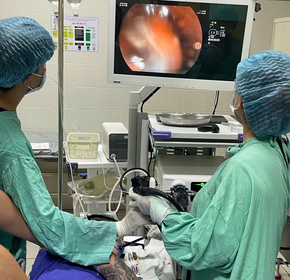 Gắp 3 b&agrave;n chải d&agrave;i gần 20cm khỏi bụng bệnh nh&acirc;n- Ảnh 1.