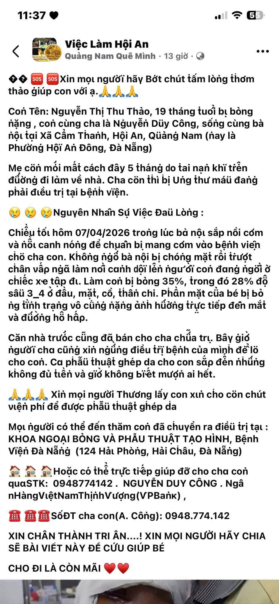 Dựng việc con g&aacute;i 19 th&aacute;ng tuổi bị bỏng nặng để lừa đảo k&ecirc;u gọi từ thiện- Ảnh 2.