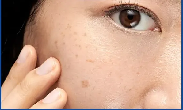 Những dấu hiệu cho thấy cơ thể l&atilde;o h&oacute;a nhanh hơn tuổi thật- Ảnh 1.