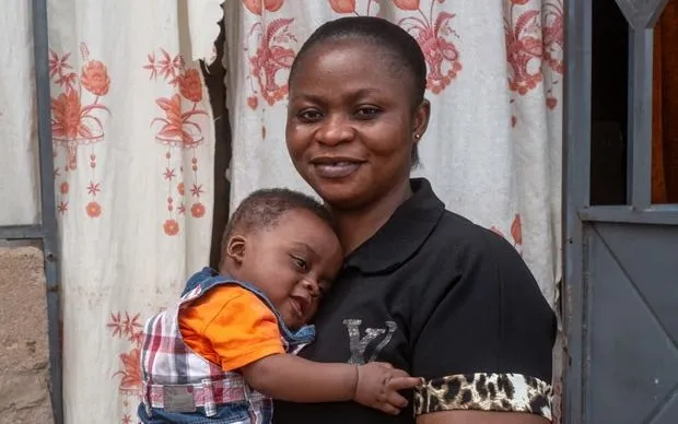 Bé Wonder là một trong những bệnh nhi đầu tiên được dùng thuốc Coartem Baby. (Ảnh: Nana Kofi Acquah/Novartis)