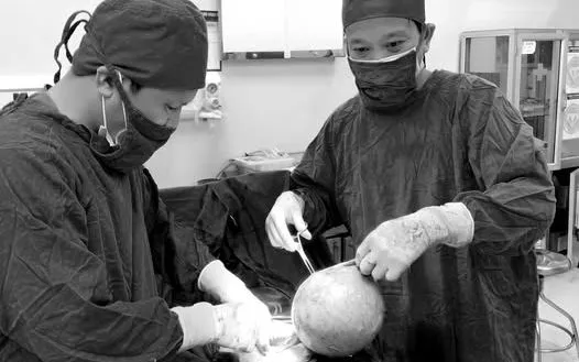 Các bác sĩ phẫu thuật cắt bỏ khối u cho bệnh nhân. Ảnh: BVCC