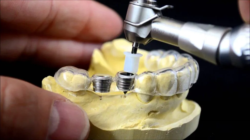 Ứng dụng c&ocirc;ng nghệ in 3D trong nha khoa: Bước tiến mới cho điều trị ch&iacute;nh x&aacute;c v&agrave; thẩm mỹ- Ảnh 1.