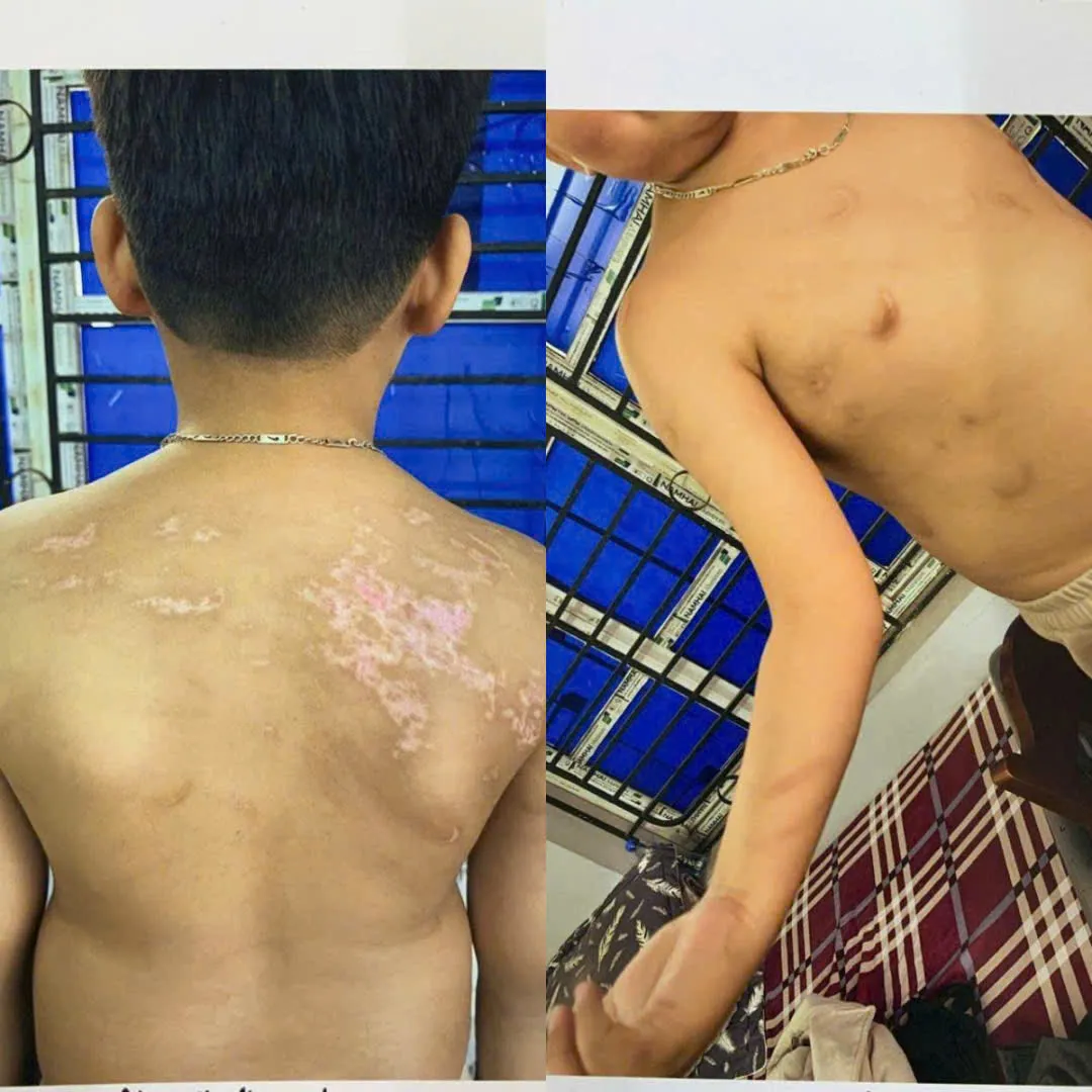 Phú Thọ: Khởi tố đối tượng bạo hành con ruột gây thương tích 36% - Ảnh 1.