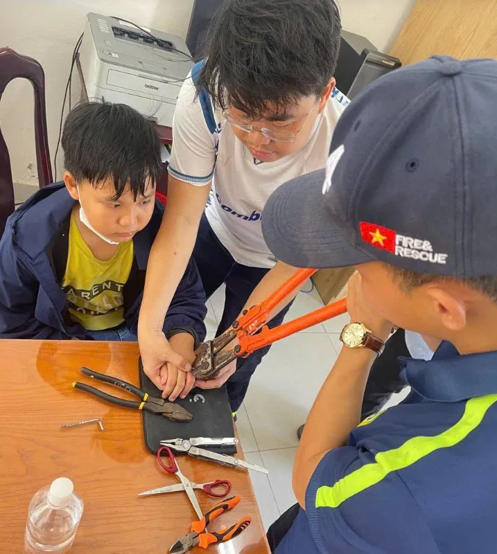 Học sinh lớp 6 bị nhiều v&ograve;ng kim loại siết chặt tay, cảnh s&aacute;t kịp thời ''giải cứu''- Ảnh 1.