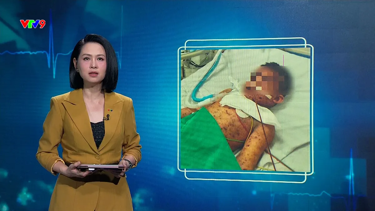 Alo doctor (14/5/2026): Bé trai 6 tuổi nguy kịch vì biến chứng nặng từ thủy đậu