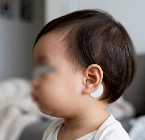 B&aacute;c sĩ cảnh b&aacute;o nguy cơ từ miếng d&aacute;n chống say t&agrave;u xe ở trẻ nhỏ- Ảnh 1.