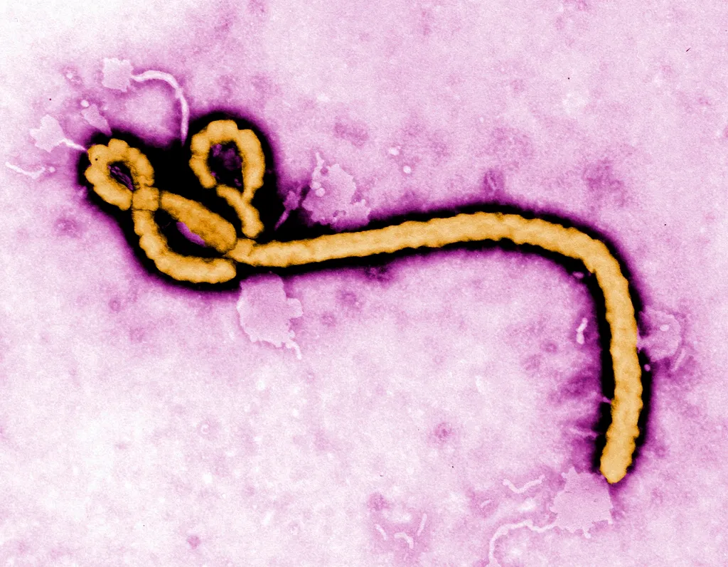 Nguy cơ l&acirc;y lan virus Ebola xuy&ecirc;n bi&ecirc;n giới - Ảnh 1.