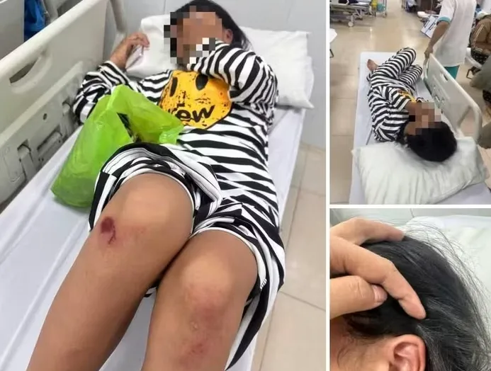 Công an khẩn trương điều tra vụ một nữ học sinh lớp 6 bị nhóm bạn đánh hội đồng, nhục mạ tàn nhẫn - Ảnh 2.