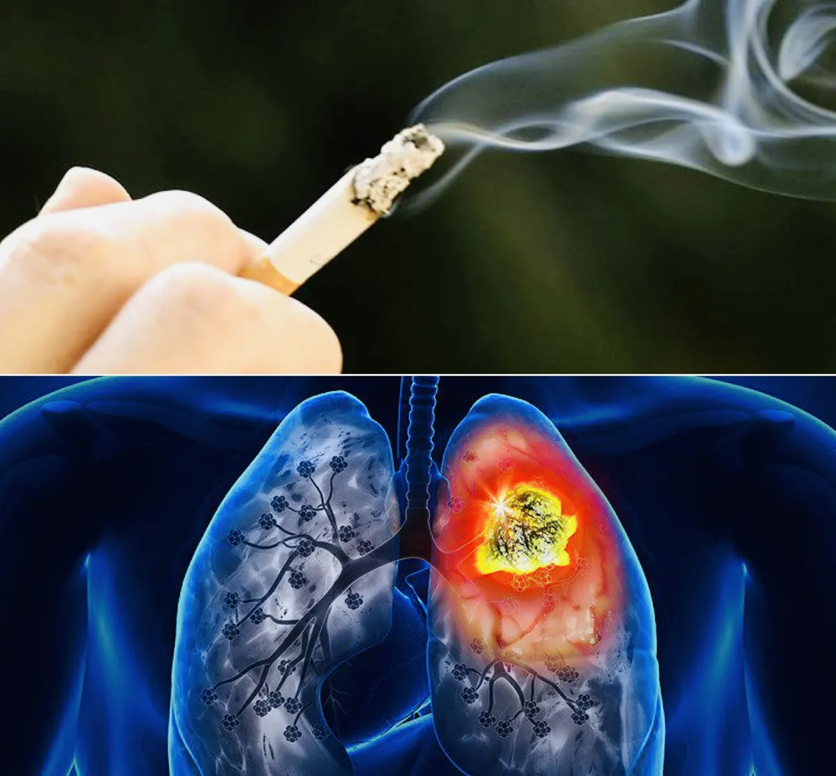 &nbsp;Người từng h&uacute;t thuốc vẫn c&oacute; nguy cơ ung thư phổi d&ugrave; đ&atilde; cai thuốc- Ảnh 1.