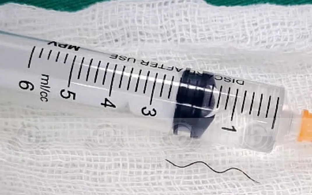 Dị vật dài hơn 2cm được lấy ra. Ảnh: Bệnh viện Quân y 4