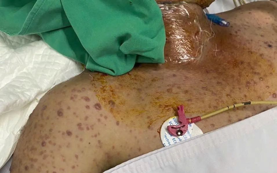 Ảnh: Bệnh viện Đa khoa TP Cần Thơ