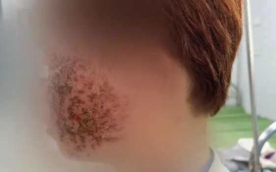 Ảnh: Bệnh viện Đa khoa Bắc Ninh số 1