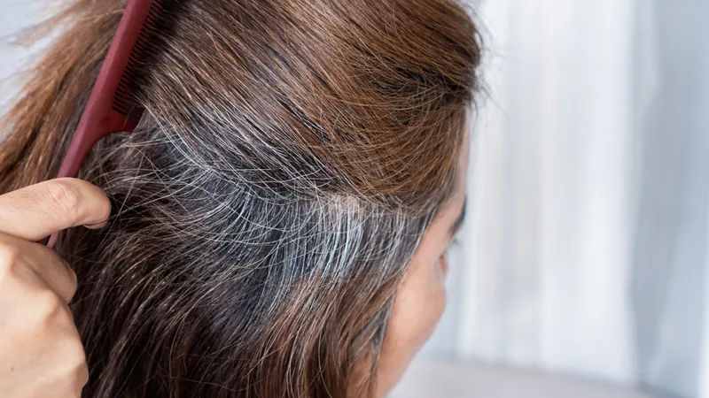 Chưa đến tuổi trưởng th&agrave;nh t&oacute;c đ&atilde; bạc, cơ thể đang muốn cảnh b&aacute;o điều g&igrave;?- Ảnh 1.