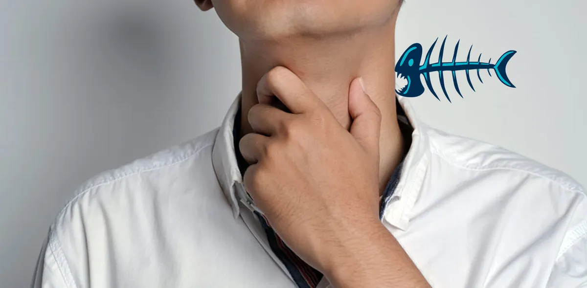 Mẹo chữa h&oacute;c xương c&aacute; tại nh&agrave;: Khi n&agrave;o n&ecirc;n &aacute;p dụng v&agrave; thời điểm cần đến bệnh viện?- Ảnh 1.