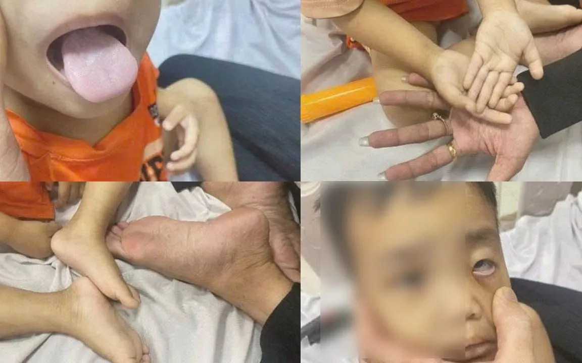 Ảnh: Bệnh viện Đa khoa Tiền Giang