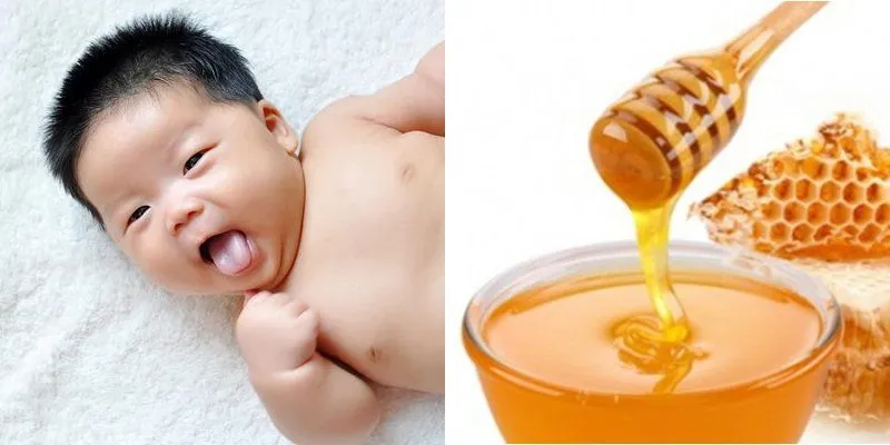 Mật ong có thực sự tốt cho trẻ sơ sinh? Chuyên gia cảnh báo nguy cơ nhiều cha mẹ vẫn chủ quan- Ảnh 1. Mật ong có thực sự tốt cho trẻ sơ sinh? Chuyên gia cảnh báo nguy cơ nhiều cha mẹ vẫn chủ quan- Ảnh 1.