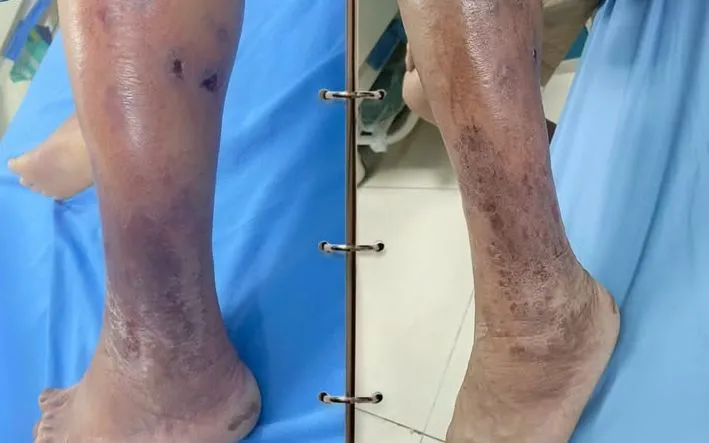 Ảnh: Trung tâm Y tế khu vực Hạ Hòa