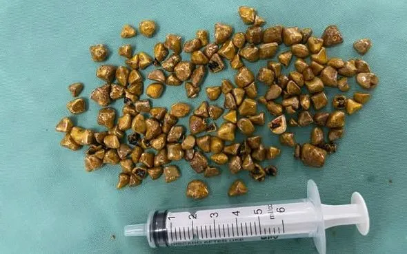 Ảnh: Bệnh viện Đa khoa Bắc Ninh số 1
