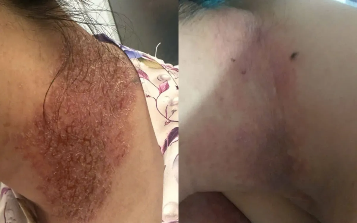 Ảnh: Bệnh viện Bệnh Nhiệt đới Trung ương